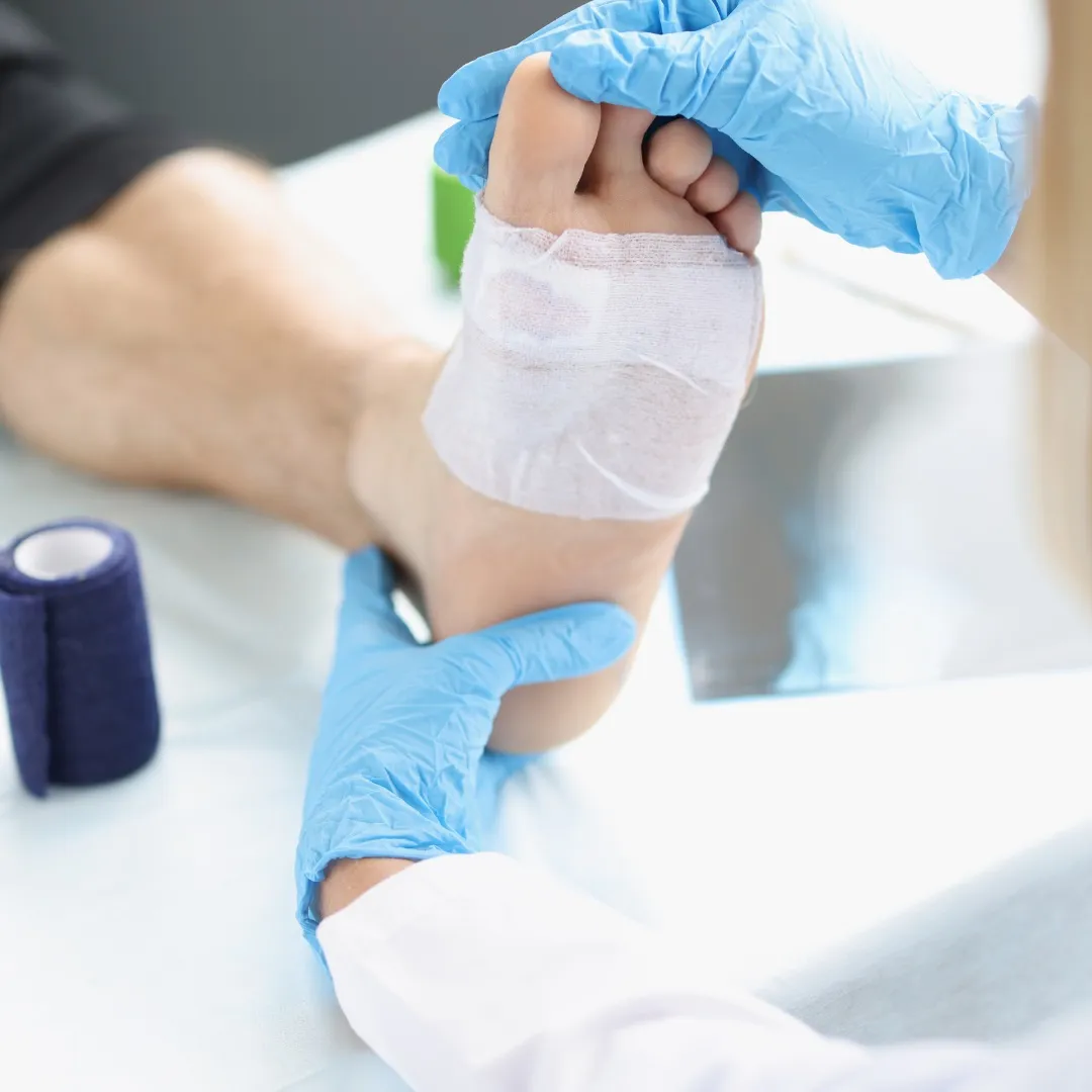 Bunion Surgery: What to Expect from Your Procedure and Recovery